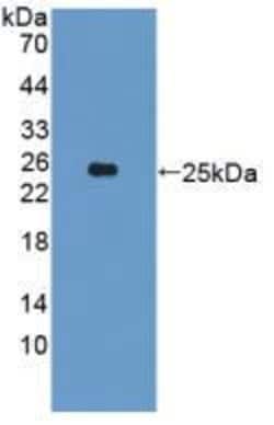 Invitrogen CYP26A1 Polyclonal Antibody 200 &mu;L; Unconjugated:Antibodies,