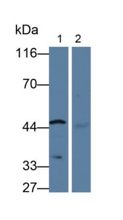 Invitrogen CYP26A1 Polyclonal Antibody:Antibodies:Primary Antibodies