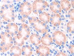 Invitrogen CYP21A2 Polyclonal Antibody:Antibodies:Primary Antibodies