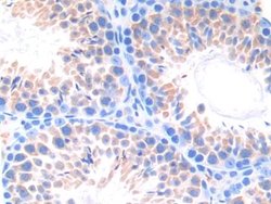 Invitrogen CYP21A2 Polyclonal Antibody:Antibodies:Primary Antibodies
