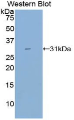 Invitrogen CYP21A2 Polyclonal Antibody:Antibodies:Primary Antibodies