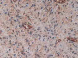 Invitrogen Cytohesin 1 Polyclonal Antibody:Antibodies:Primary Antibodies