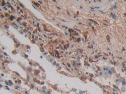Invitrogen Cytohesin 1 Polyclonal Antibody:Antibodies:Primary Antibodies