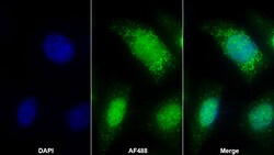Invitrogen Cytokeratin 1 Polyclonal Antibody 20 &mu;L; Unconjugated:Antibodies,