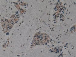 Invitrogen Cytokeratin 1 Polyclonal Antibody:Antibodies:Primary Antibodies