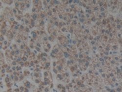 Invitrogen Cytokeratin 1 Polyclonal Antibody:Antibodies:Primary Antibodies