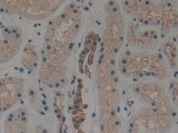 Invitrogen Cytokeratin 1 Polyclonal Antibody:Antibodies:Primary Antibodies