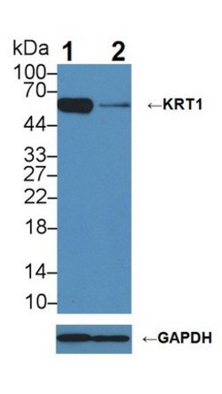 Invitrogen Cytokeratin 1 Polyclonal Antibody:Antibodies:Primary Antibodies