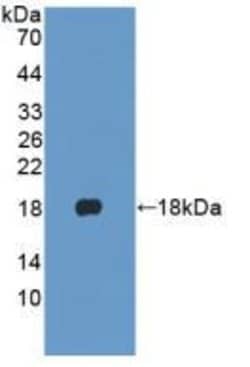 Invitrogen Cytokeratin 1 Polyclonal Antibody:Antibodies:Primary Antibodies