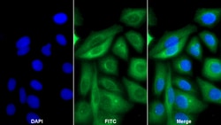 Invitrogen Cytokeratin 18 Polyclonal Antibody 200 &mu;L; Unconjugated:Antibodies,