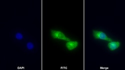 Invitrogen Cytokeratin 18 Polyclonal Antibody 200 &mu;L; Unconjugated:Antibodies,