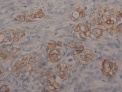 Invitrogen Cytokeratin 18 Polyclonal Antibody 200 &mu;L; Unconjugated:Antibodies,
