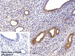 Invitrogen Cytokeratin 18 Polyclonal Antibody 200 &mu;L; Unconjugated:Antibodies,