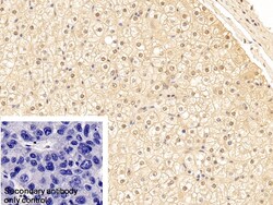 Invitrogen Cytokeratin 18 Polyclonal Antibody 200 &mu;L; Unconjugated:Antibodies,