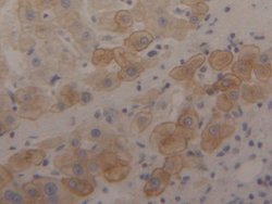 Invitrogen Cytokeratin 18 Polyclonal Antibody 200 &mu;L; Unconjugated:Antibodies,