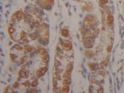 Invitrogen Cytokeratin 18 Polyclonal Antibody 200 &mu;L; Unconjugated:Antibodies,