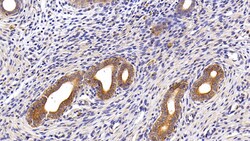Invitrogen Cytokeratin 18 Polyclonal Antibody 200 &mu;L; Unconjugated:Antibodies,
