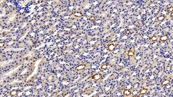 Invitrogen Cytokeratin 18 Polyclonal Antibody 200 &mu;L; Unconjugated:Antibodies,