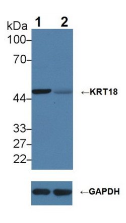 Invitrogen Cytokeratin 18 Polyclonal Antibody 200 &mu;L; Unconjugated:Antibodies,