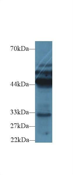 Invitrogen Cytokeratin 18 Polyclonal Antibody 200 &mu;L; Unconjugated:Antibodies,
