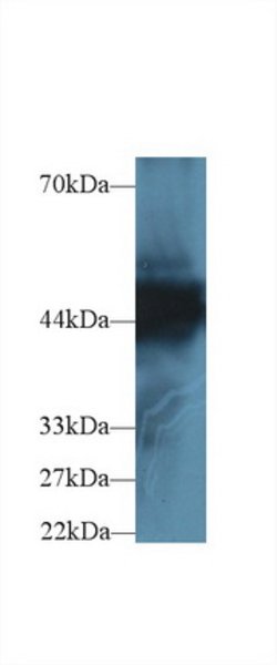 Invitrogen Cytokeratin 18 Polyclonal Antibody 200 &mu;L; Unconjugated:Antibodies,