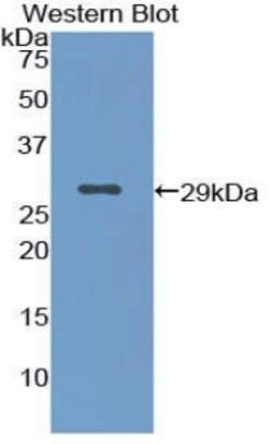Invitrogen Cytokeratin 18 Polyclonal Antibody 200 &mu;L; Unconjugated:Antibodies,