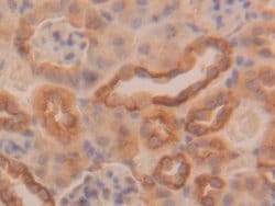 Invitrogen Cytokeratin 18 Polyclonal Antibody:Antibodies:Primary Antibodies