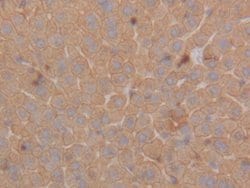 Invitrogen Cytokeratin 18 Polyclonal Antibody:Antibodies:Primary Antibodies