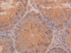 Invitrogen Cytokeratin 18 Polyclonal Antibody:Antibodies:Primary Antibodies