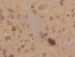 Invitrogen Cytokeratin 18 Polyclonal Antibody:Antibodies:Primary Antibodies