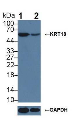 Invitrogen Cytokeratin 18 Polyclonal Antibody:Antibodies:Primary Antibodies