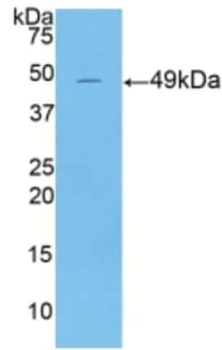 Invitrogen Cytokeratin 18 Polyclonal Antibody:Antibodies:Primary Antibodies