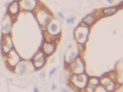 Invitrogen Cytokeratin 19 Polyclonal Antibody 200 &mu;L; Unconjugated:Antibodies,
