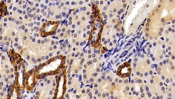 Invitrogen Cytokeratin 19 Polyclonal Antibody 200 &mu;L; Unconjugated:Antibodies,