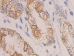 Invitrogen Cytokeratin 19 Polyclonal Antibody 200 &mu;L; Unconjugated:Antibodies,