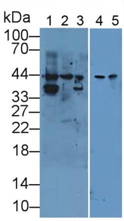 Invitrogen Cytokeratin 19 Polyclonal Antibody 200 &mu;L; Unconjugated:Antibodies,