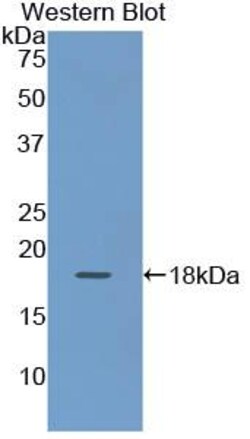 Invitrogen Cytokeratin 19 Polyclonal Antibody 200 &mu;L; Unconjugated:Antibodies,