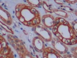 Invitrogen Cytokeratin 8 Polyclonal Antibody:Antibodies:Primary Antibodies