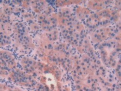 Invitrogen Cytokeratin 8 Polyclonal Antibody:Antibodies:Primary Antibodies