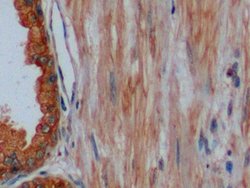 Invitrogen Cytokeratin 8 Polyclonal Antibody:Antibodies:Primary Antibodies