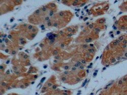 Invitrogen Cytokeratin 8 Polyclonal Antibody:Antibodies:Primary Antibodies