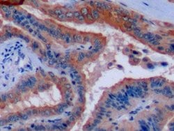 Invitrogen Cytokeratin 8 Polyclonal Antibody:Antibodies:Primary Antibodies