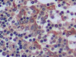 Invitrogen Cytokeratin 8 Polyclonal Antibody:Antibodies:Primary Antibodies
