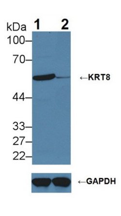 Invitrogen Cytokeratin 8 Polyclonal Antibody:Antibodies:Primary Antibodies