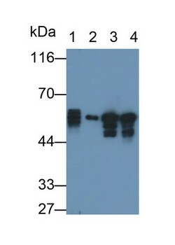 Invitrogen Cytokeratin 8 Polyclonal Antibody:Antibodies:Primary Antibodies