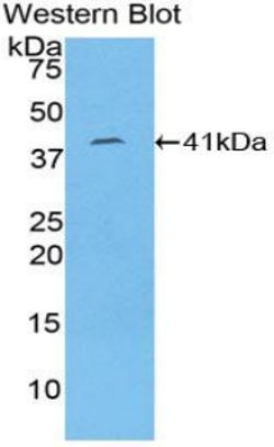 Invitrogen Cytokeratin 8 Polyclonal Antibody:Antibodies:Primary Antibodies