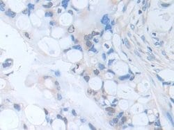 Invitrogen SERPINB9 Polyclonal Antibody 20 &mu;L; Unconjugated:Antibodies,