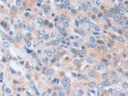Invitrogen SERPINB9 Polyclonal Antibody 20 &mu;L; Unconjugated:Antibodies,