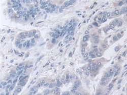 Invitrogen DATF1 Polyclonal Antibody 20 &mu;L; Unconjugated:Antibodies,
