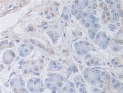 Invitrogen DATF1 Polyclonal Antibody 20 &mu;L; Unconjugated:Antibodies,